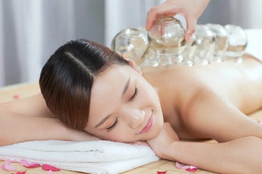 cupping, wet cupping, dry cupping