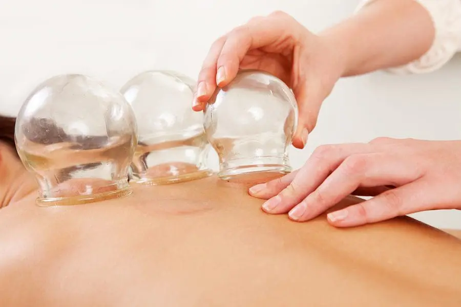 cupping, therapy, cups