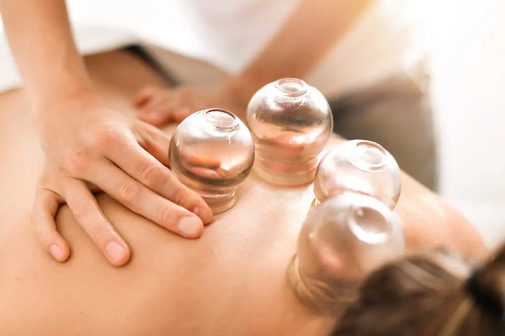 Close-up of a practitioner performing cupping therapy on a patient’s back, demonstrating holistic pain relief and healing.