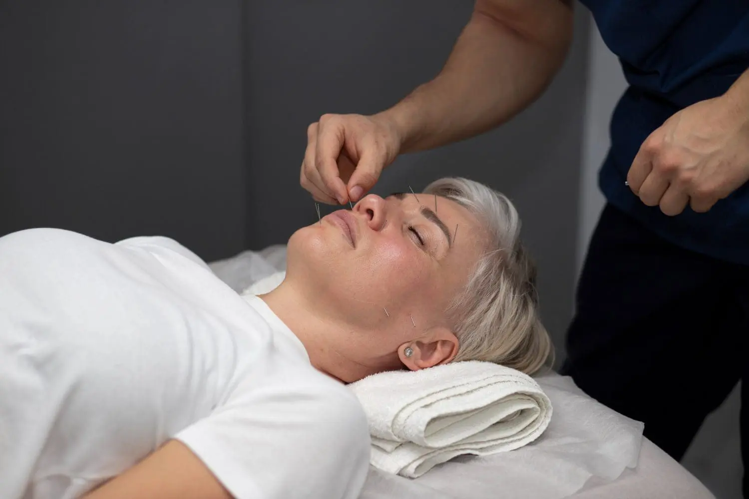 A practitioner placing acupuncture needles on the face of a deeply relaxed patient to relieve stress at a Scottsdale acupuncture clinic.