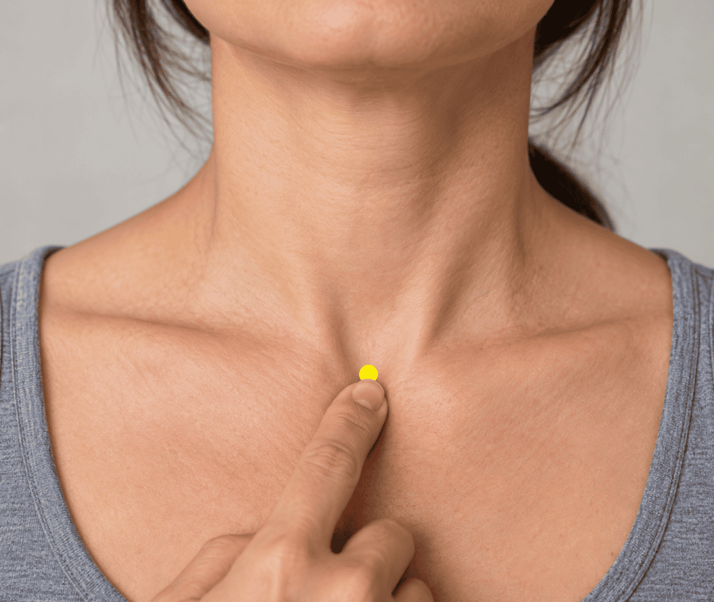 Close-up of the base of the front of the neck with a yellow dot marker in the notch just above the top of the breastbone, indicating CV22.