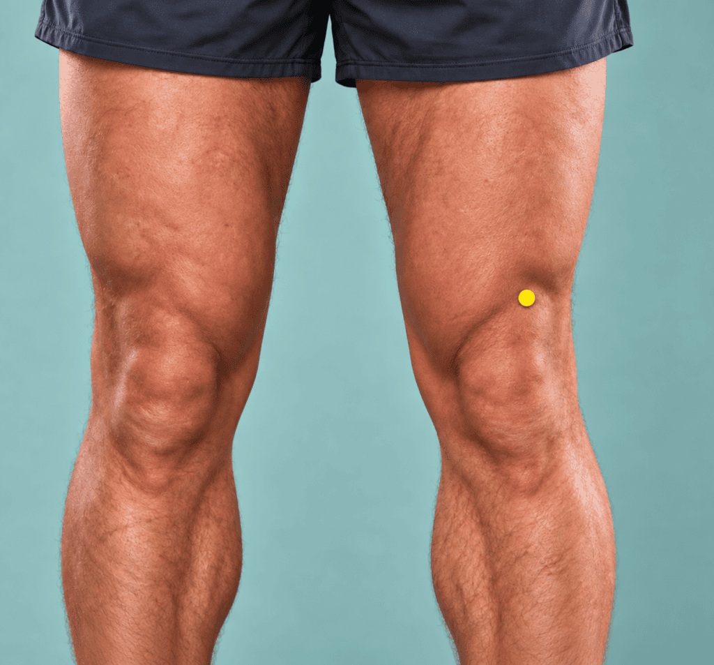 Close-up of the front of a thigh with a yellow dot marker three finger-widths above the outer upper corner of the kneecap, indicating ST34.