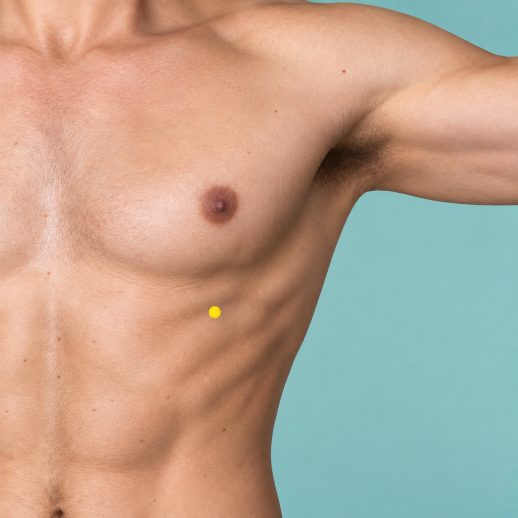 Close-up of a chest with yellow dot markers below each nipple in the space between the ribs, indicating LR14.