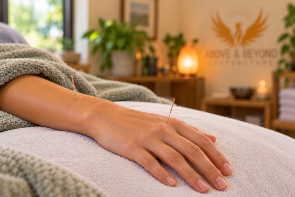 Close-up of a relaxed hand and forearm resting on a treatment table with two fine acupuncture needles inserted into the skin.