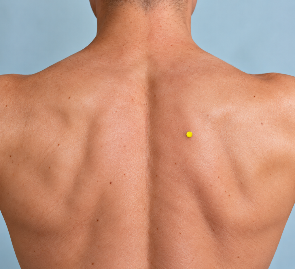 Close-up of the upper back, with yellow dots marking BL42 along the inner edges of the shoulder blades.