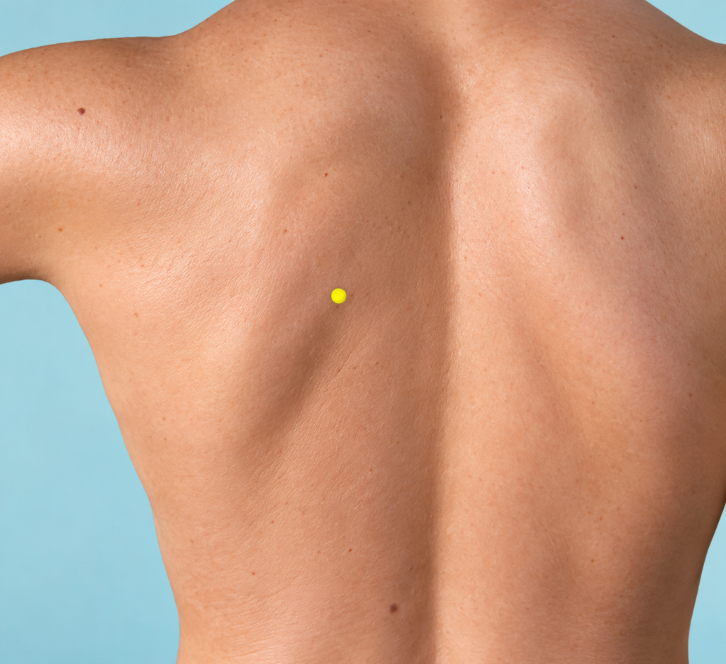 Close-up of the upper back, with yellow dots marking BL44 along the inner edges of the shoulder blades.