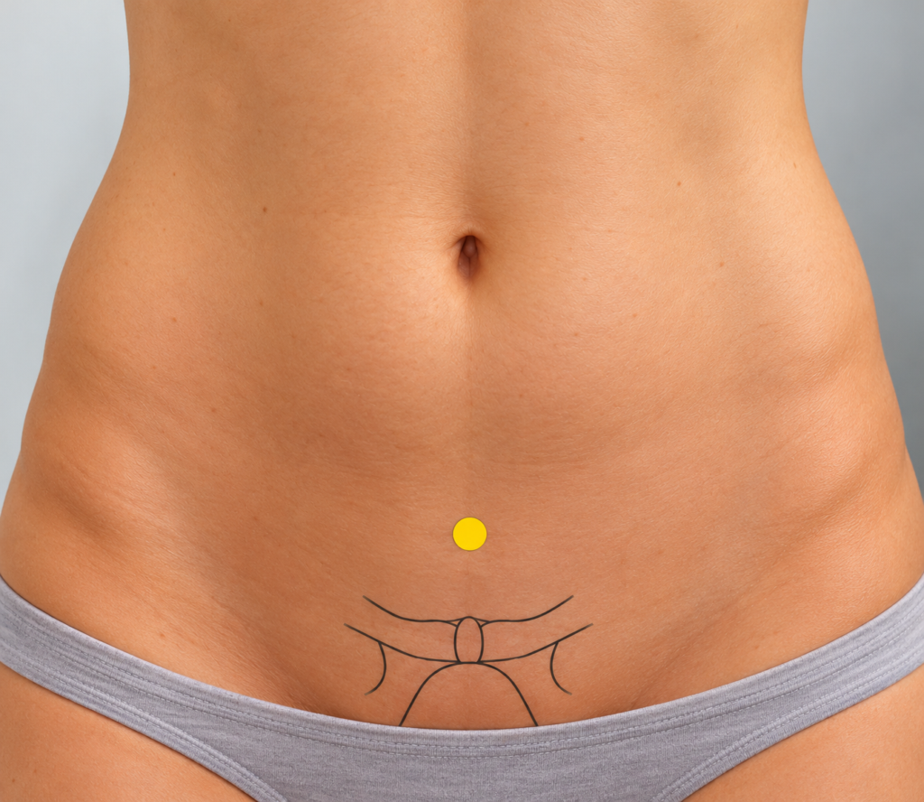 Close-up of the lower abdomen over fitted clothing, with a yellow dot marking CV3 above the pubic bone.