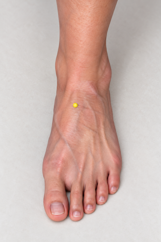 Close-up of the top of the foot, with a yellow dot marking ST42 at its highest point where the pulse can be felt.