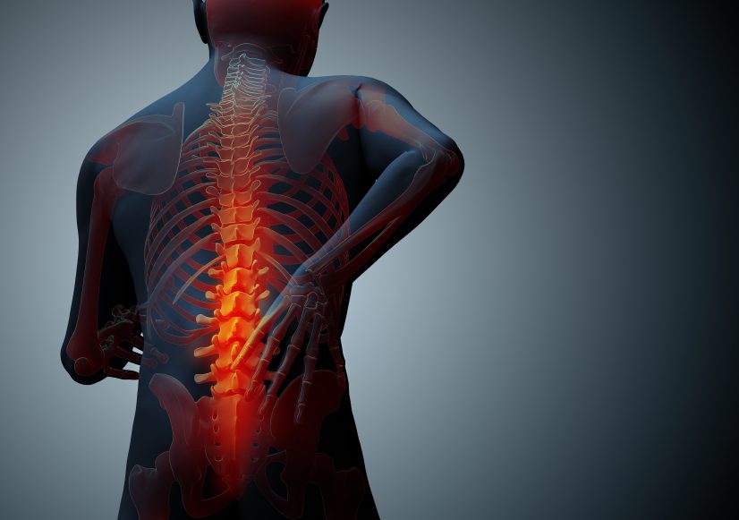 back pain acupuncture