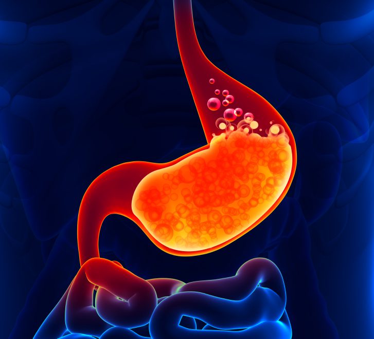 acid reflux, acupuncture, scottsdale