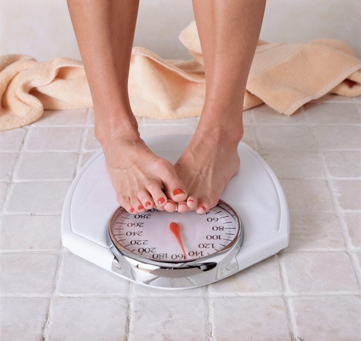 weight loss, obesity, acupuncture