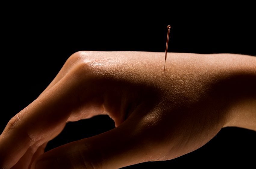 acupuncture, pain, health