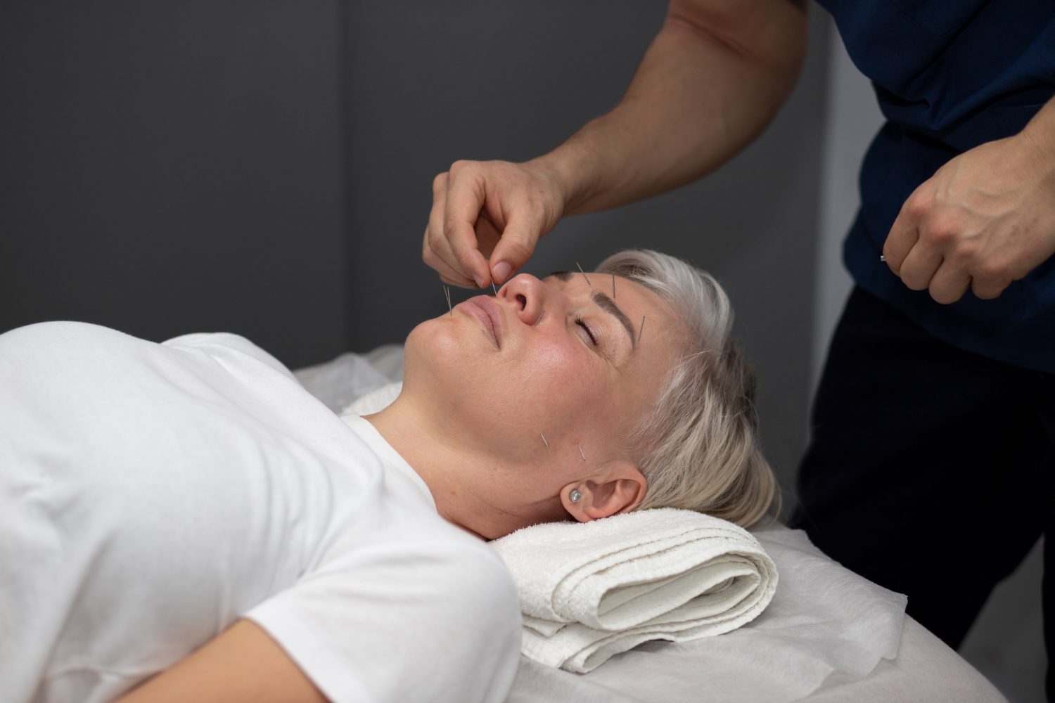 A practitioner placing acupuncture needles on the face of a deeply relaxed patient to relieve stress at a Scottsdale acupuncture clinic.