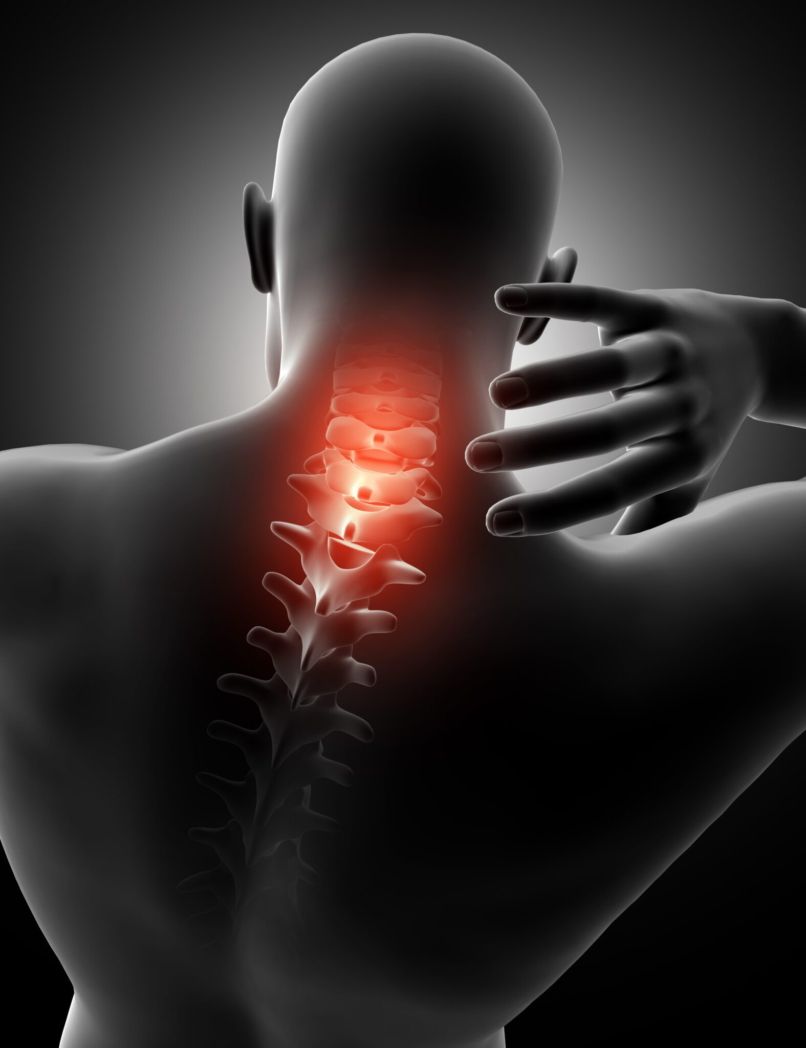 A 3D medical illustration of a human torso from the back, highlighting the cervical spine in glowing red to represent chronic neck and upper back pain.