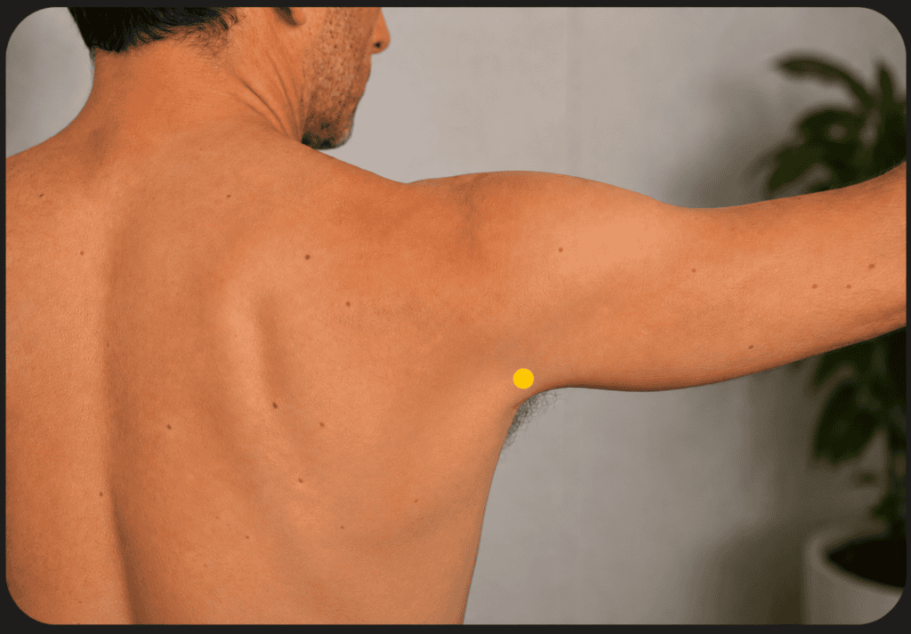 Close-up of the back of a shoulder with a yellow dot marker about one thumb-width above the back of the armpit crease, indicating the location of SI9.