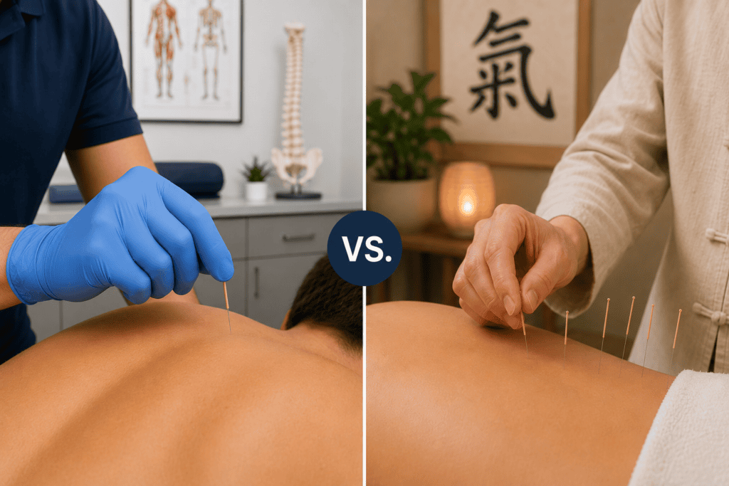 Side-by-side comparison of dry needling performed with a gloved hand and traditional acupuncture performed with multiple acupuncture needles.