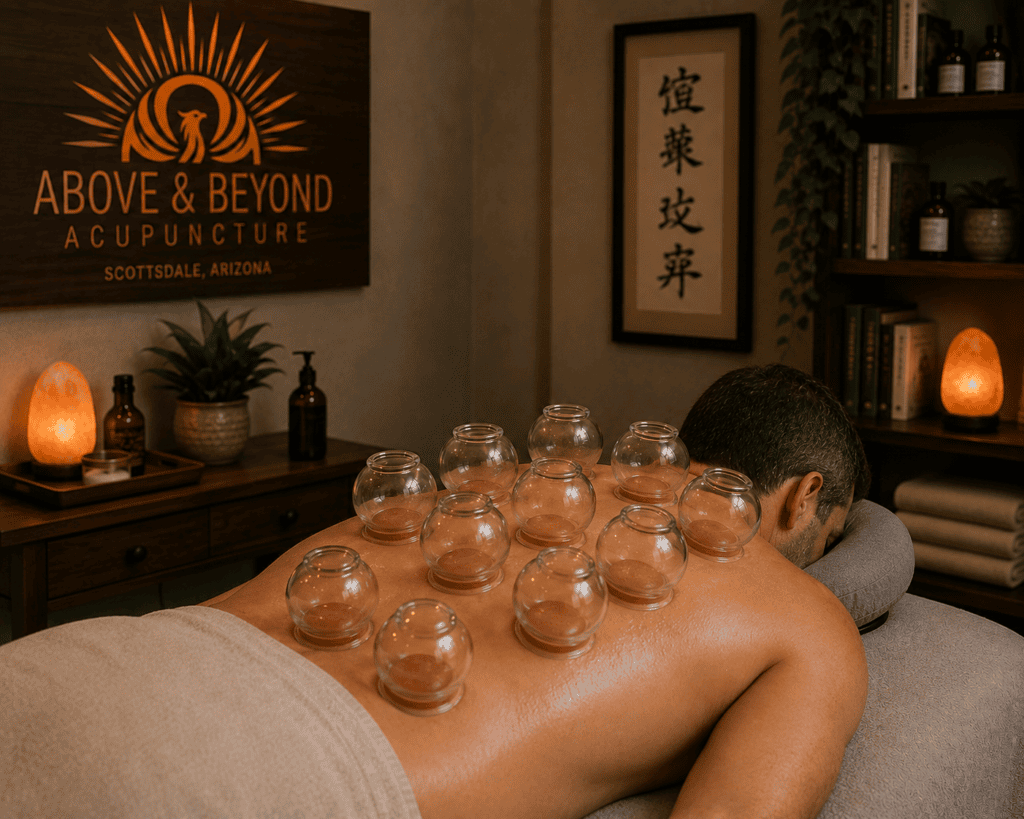 Fire cupping applied to the upper back and shoulders showing the specialty treatment regions at Above and Beyond Acupuncture.