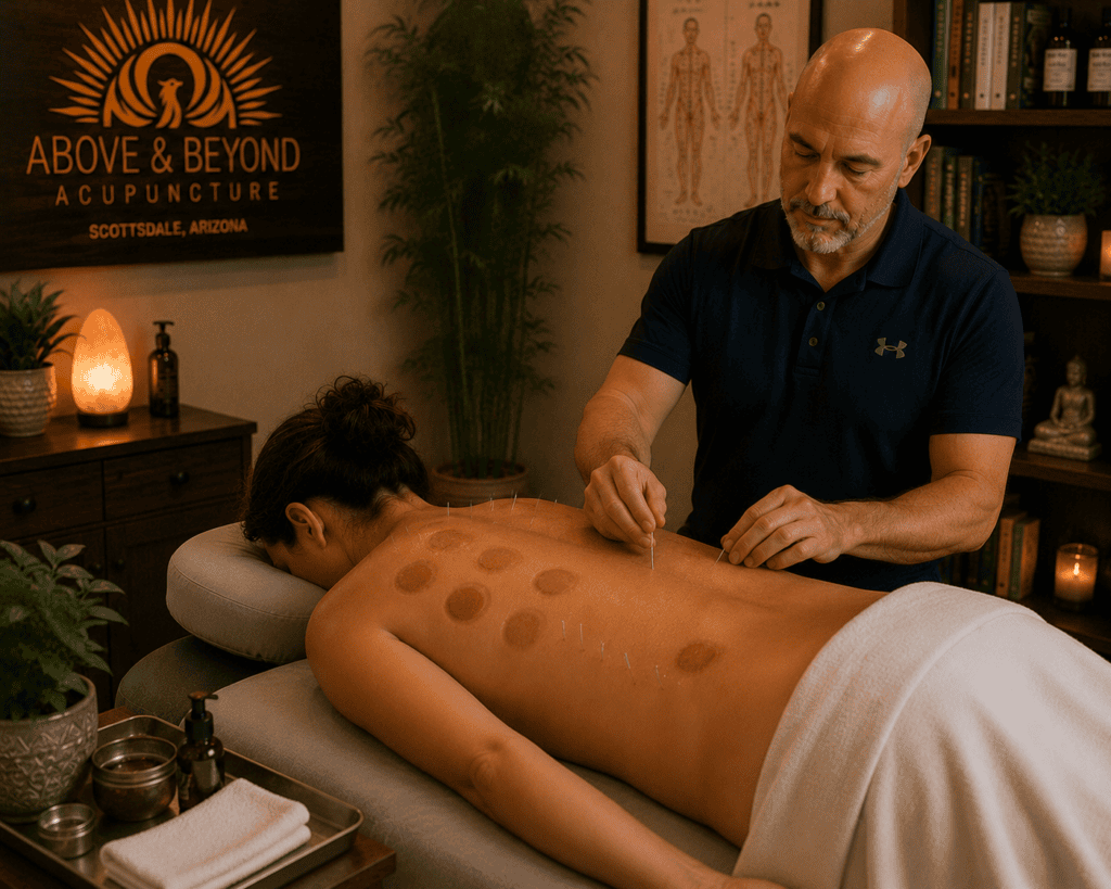 Licensed acupuncturist performing fire cupping alongside acupuncture treatment as part of an integrated session.