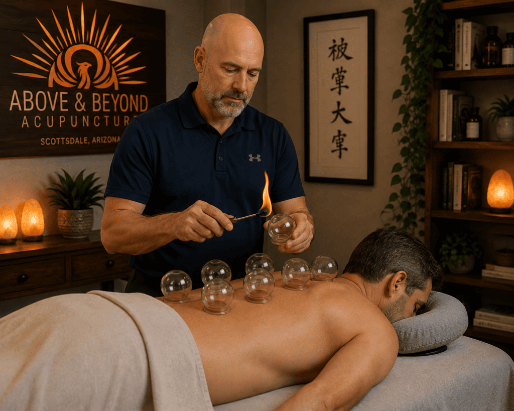 Licensed acupuncturist performing traditional fire cupping using glass cups on a patient's back at Above and Beyond Acupuncture.