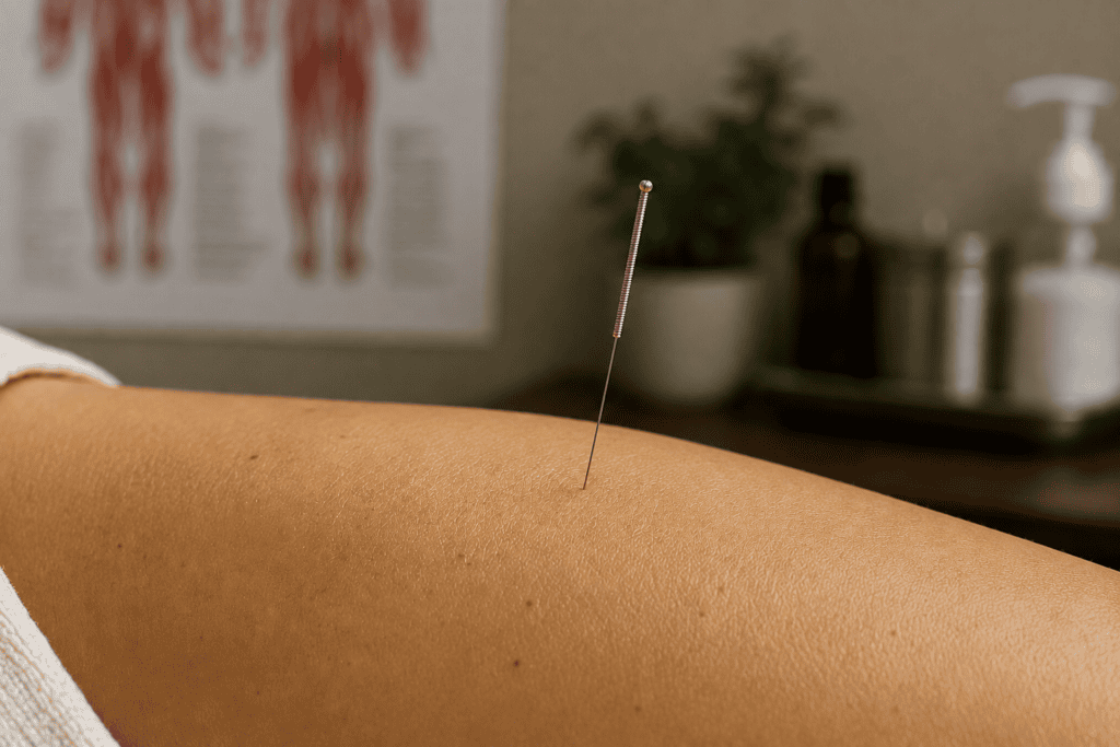 Close-up of a fine acupuncture needle placed in the skin where local blood flow increases.