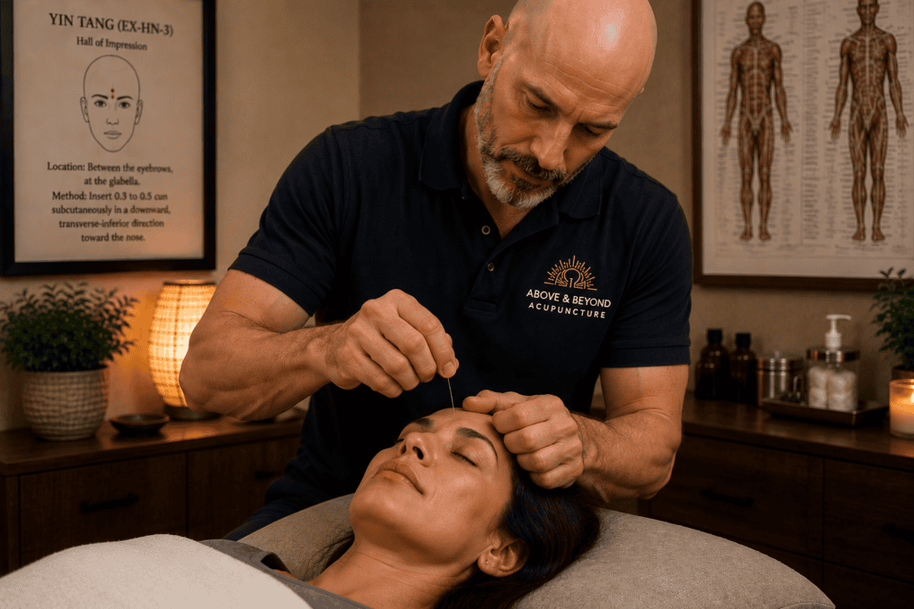 Licensed acupuncturist placing a fine needle as the body responds by releasing natural pain-relieving chemicals.