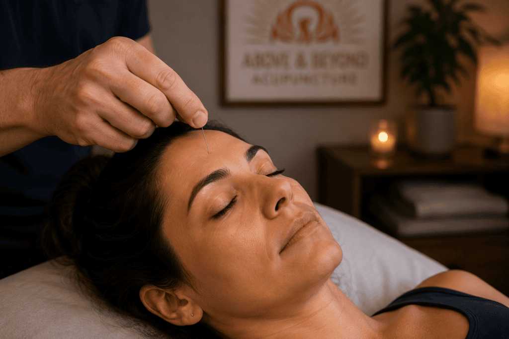 Close-up of a fine acupuncture needle placed at the point between the eyebrows during treatment.