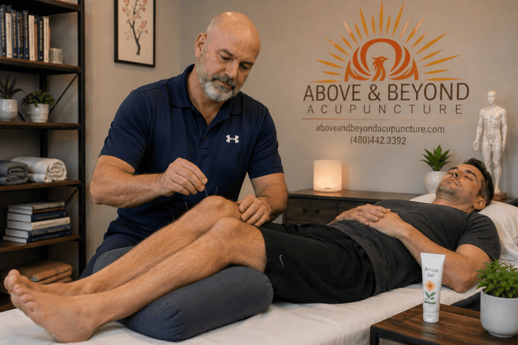 Acupuncturist treating a patient for a leg injury with Arnica gel nearby for supportive home care.
