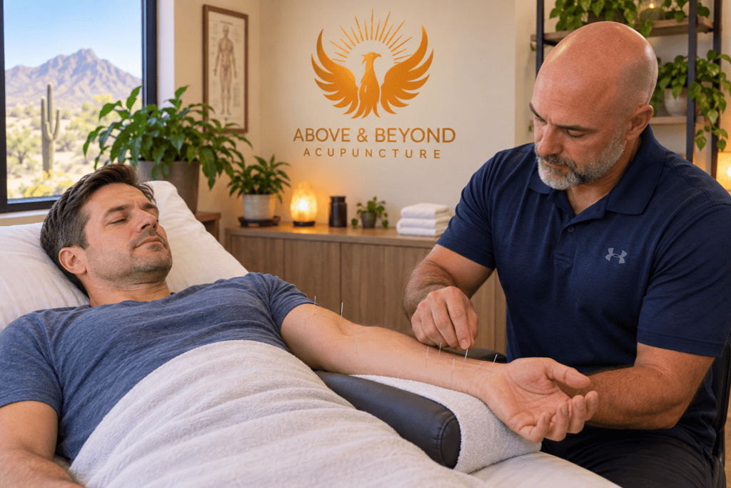 Man receiving acupuncture around the wrist and forearm for mild to moderate carpal tunnel symptoms.